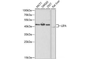 Western blot analysis of extracts of various cell lines using LIPA Polyclonal Antibody at dilution of 1:1000. (Lipase A Antikörper)
