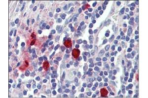 Tonsil, mast cells, Human: Formalin-Fixed, Paraffin-Embedded (FFPE) (CMA1 Antikörper)