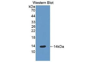 Detection of Recombinant ENA78, Human using Polyclonal Antibody to Epithelial Neutrophil Activating Peptide 78 (ENA78) (CXCL5 Antikörper  (AA 41-132))
