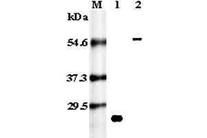 Western blot analysis using anti-RANK (human), pAb  at 1:5,000 dilution. (TNFRSF11A Antikörper)