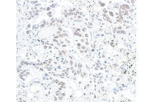 Immunohistochemistry (IHC) image for anti-Nucleoprotein TPR (TPR) (C-Term) antibody (ABIN7448922) (TPR Antikörper  (C-Term))