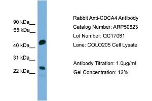 WB Suggested Anti-CDCA4  Antibody Titration: 0.