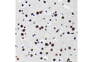 Immunohistochemistry of paraffin-embedded mouse brain using K/TRIM28 antibody (ABIN7270986) at dilution of 1:100 (40x lens). (KAP1 Antikörper)