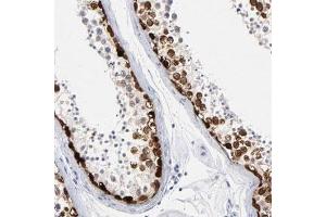 Immunohistochemical staining (Formalin-fixed paraffin-embedded sections) of human testis shows strong nuclear positivity in spermatogonia and spermatocytes. (RHOXF2 Antikörper)