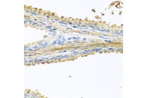Immunohistochemistry of paraffin-embedded human prostate using PIP antibody (ABIN6131693, ABIN6145670, ABIN6145672 and ABIN6222022) at dilution of 1:100 (40x lens). (PIP Antikörper  (AA 29-146))