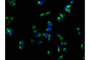 Immunofluorescence staining of Hela cells with ABIN7175125 at 1:133, counter-stained with DAPI. (PLAUR Antikörper  (AA 23-305))