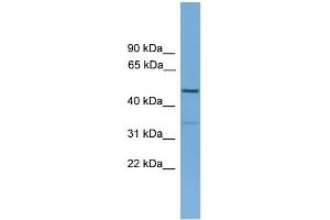 WB Suggested Anti-ARHGAP1 Antibody Titration: 0. (ARHGAP1 Antikörper  (N-Term))