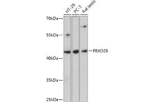 Western blot analysis of extracts of various cell lines, using FBXO28 antibody (ABIN7267088) at 1:1000 dilution. (FBXO28 Antikörper  (AA 91-312))