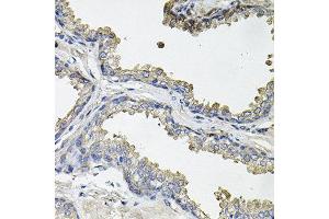 Immunohistochemistry of paraffin-embedded human prostate using ACO1 antibody at dilution of 1:100 (x40 lens).