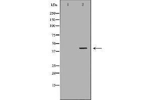 Western blot analysis of extracts of K562, using ABO antibody. (ABO Antikörper  (N-Term))