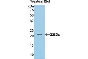 Western blot analysis of the recombinant protein. (LCAT Antikörper  (AA 41-210))