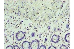 Immunohistochemistry of paraffin-embedded human colon tissue using ABIN7167058 at dilution of 1:100 (RSAD2 Antikörper  (AA 42-361))