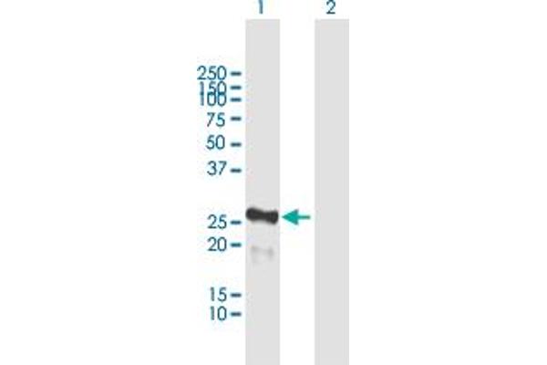 MIS12 Antikörper  (AA 1-205)