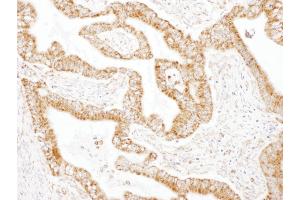 Immunohistochemistry (IHC) image for anti-Glutamic-Oxaloacetic Transaminase 2, Mitochondrial (Aspartate Aminotransferase 2) (GOT2) (AA 380-430) antibody (ABIN7454581) (GOT2 Antikörper  (AA 380-430))