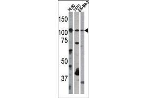 Image no. 1 for anti-Retinoblastoma 1 (RB1) (pSer612) antibody (ABIN358212) (Retinoblastoma 1 Antikörper  (pSer612))