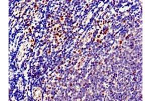 Immunohistochemistry of paraffin-embedded human lymph node tissue using ABIN7150733 at dilution of 1:100 (Mps1 Antikörper  (AA 370-492))