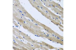 Immunohistochemistry of paraffin-embedded rat heart using ST8SIA2 antibody at dilution of 1:100 (x40 lens).