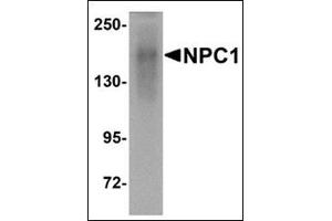 Western blot analysis of NPC1 in human kidney tissue lysate with this product at 1 μg/ml. (NPC1 Antikörper  (C-Term))