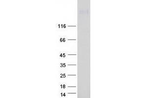 Western Blotting (WB) image for ATPase, Ca++ Transporting, Plasma Membrane 4 (ATP2B4) (Transcript Variant 2) protein (Myc-DYKDDDDK Tag) (ABIN2715045)