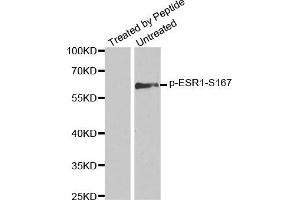 Western blot analysis of extracts from MCF7 cells using Phospho-ESR1-S167 antibody. (Estrogen Receptor alpha Antikörper  (pSer167))