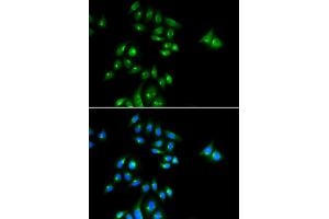 Immunofluorescence analysis of U2OS cell using PHC3 antibody. (PHC3 Antikörper)