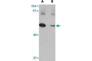 Western blot analysis of SLC22A17 in SK-N-SH lysate with SLC22A17 polyclonal antibody  at 1 ug/mL in (A) the absence and (B) the presence of blocking peptide. (SLC22A17 Antikörper  (C-Term))