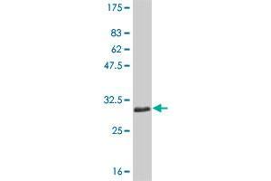 Western Blot detection against Immunogen (30. (SLC11A1 Antikörper  (AA 308-350))