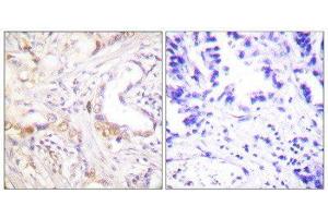 Immunohistochemistry (IHC) image for anti-Protein Inhibitor of Activated STAT, 3 (PIAS3) (N-Term) antibody (ABIN1848836) (PIAS3 Antikörper  (N-Term))