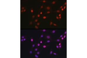 Immunofluorescence (IF) image for anti-O-Linked N-Acetylglucosamine (GlcNAc) Transferase (UDP-N-Acetylglucosamine:polypeptide-N-Acetylglucosaminyl Transferase) (OGT) (AA 857-1036) antibody (ABIN3022708)