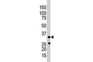 The PRKAB1 polyclonal antibody  is used in Western blot to detect PRKAB1 in mouse spleen tissue lysate . (PRKAB1 Antikörper  (N-Term))