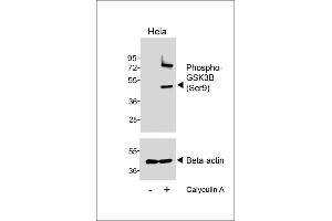Western blot analysis of lysates from Hela cell line, untreated or treated with Calyculin A, 100nM, 30 min, using Phospho--GSK3B (Ser9) Antibody (upper) or Beta-actin (lower). (GSK3 beta Antikörper  (pSer9))