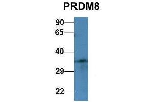 Host:  Rabbit  Target Name:  PRDM8  Sample Type:  293T  Antibody Dilution:  1. (PRDM8 Antikörper  (N-Term))