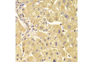 Immunohistochemistry of paraffin-embedded human liver injury using TRAF3IP2 Antibody (ABIN5974104) at dilution of 1/100 (40x lens). (TRAF3IP2 Antikörper)