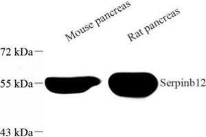 Western Blotting (WB) image for anti-serpin Peptidase Inhibitor, Clade B (Ovalbumin), Member 12 (SERPINB12) antibody (ABIN7075568)