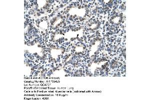 Human Lung (KCTD6 Antikörper  (N-Term))