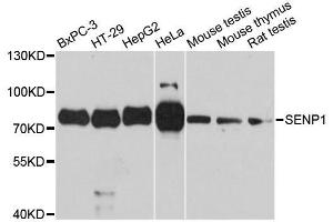 Western blot analysis of extracts of various cell lines, using SENP1 antibody. (SENP1 Antikörper  (AA 220-420))