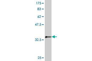 Western Blot detection against Immunogen (37. (SKP1 Antikörper  (AA 53-160))