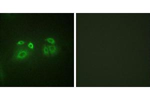 Peptide - +Immunofluorescence analysis of A549 cells, using Arrestin 1 (Ab-412) antibody. (SAG Antikörper  (Ser412))
