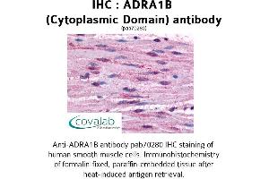 Image no. 1 for anti-Adrenergic, alpha-1B-, Receptor (ADRA1B) (3rd Cytoplasmic Domain) antibody (ABIN1731573) (ADRA1B Antikörper  (3rd Cytoplasmic Domain))