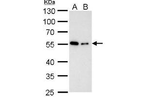 WB Image Alpha Tubulin antibody detects alpha Tubulin protein by western blot analysis. (TUBA1B Antikörper)