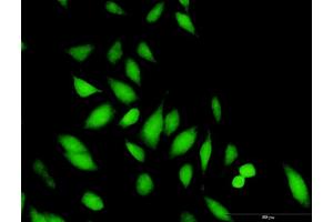 Immunofluorescence of purified MaxPab antibody to STAP1 on HeLa cell. (STAP1 Antikörper  (AA 1-295))