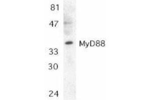 Western Blotting (WB) image for anti-Myeloid Differentiation Primary Response Gene (88) (MYD88) (AA 279-296) antibody (ABIN2475775) (MYD88 Antikörper  (AA 279-296))