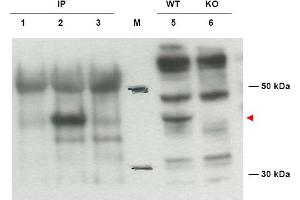 Image no. 1 for anti-Diaphanous Homolog 2 (DIAPH2) (AA 1085-1101), (Isoform 2) antibody (ABIN401289) (DIAPH2 Antikörper  (Isoform 2))