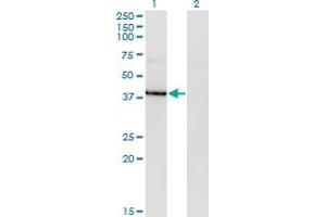 HDAC8 Antikörper  (AA 1-100)