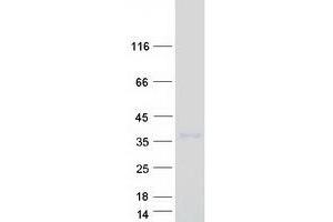 Validation with Western Blot (LRRC3B Protein (Myc-DYKDDDDK Tag))