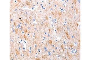 Immunohistochemistry (IHC) image for anti-KiSS-1 Metastasis-Suppressor (KISS1) antibody (ABIN1680598) (KISS1 Antikörper)