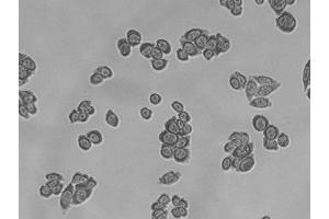 SDS-PAGE (SDS) image for Pertussis Toxin (ARTC) (Active) protein (ABIN2452202) (Pertussis Toxin Protein (ARTC))