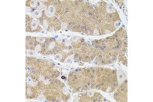 Immunohistochemistry of paraffin-embedded human stomach using MMP9 antibody (ABIN4904399) at dilution of 1:100 (40x lens). (MMP 9 Antikörper)
