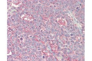 Anti-p21-ARC / ARPC3 antibody IHC staining of human tonsil. (ARPC3 Antikörper  (HRP))