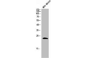 Western Blot analysis of MDA-MB-435 cells using GAS3 Polyclonal Antibody (PMP22 Antikörper  (C-Term))